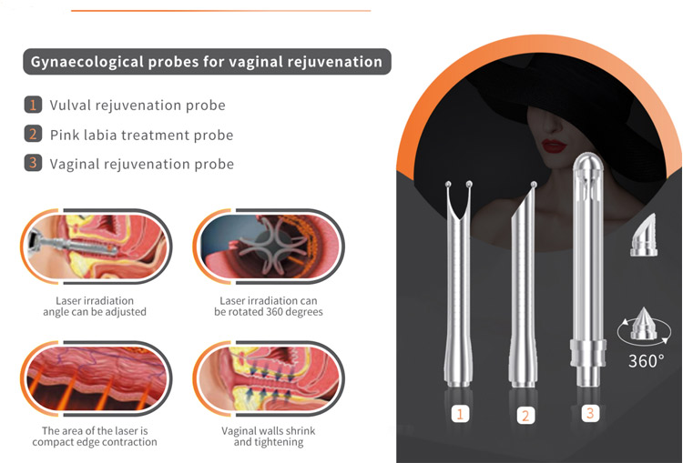 Gynaecological-probes-for-vaginal-rejuvenation.jpg