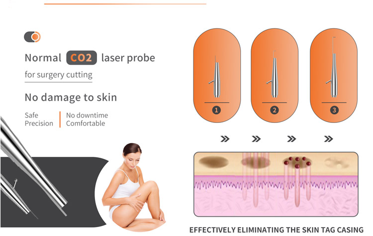 Normal-Co2-laser-probe-for-surgery-cutting.jpg