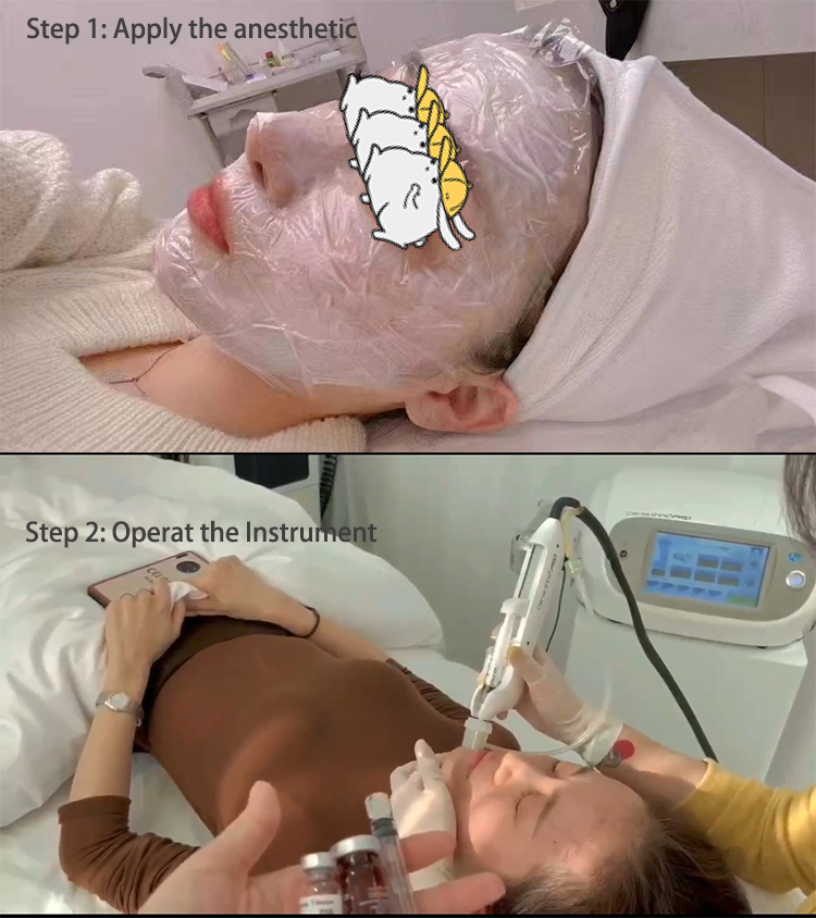 operation.jpg
