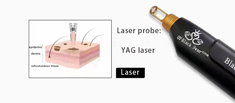 Mini pico laser probe.jpg